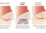 Magneto STYM - głęboka stymulacja elektromagnetyczna