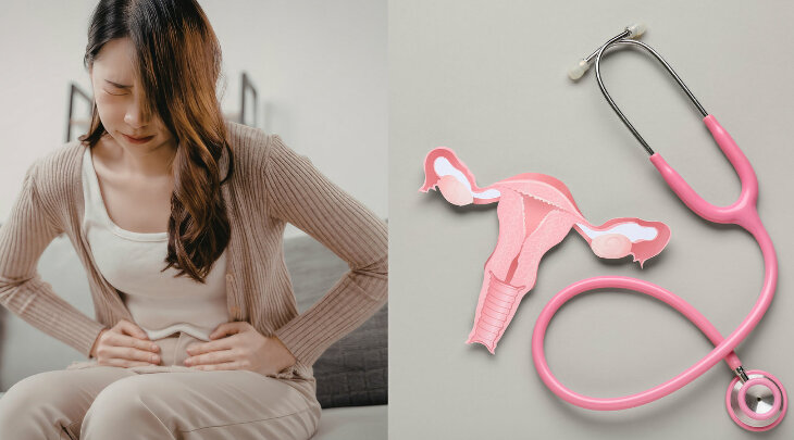 Bóle miesiączkowe, PMS, nieregularne cykle i infekcje intymne - jak Polki reagują na problemy ginekologiczne?