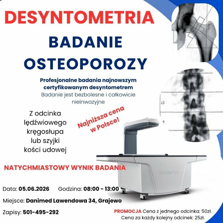 Zapisz się na badanie osteoporozy 5 VI - tel. 501 495 292